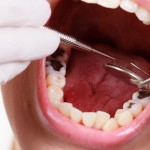 18436282_l-dental treatment