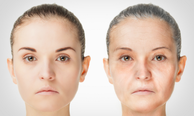 A Nonsurgical Way to Have Fewer Wrinkles and Tighter Facial Skin