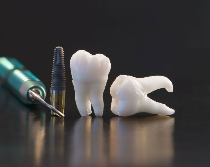 5 Real Benefits Of Dentures In Howell NJ