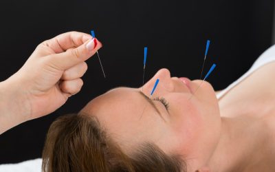 Realign Your Wellness Goals with Acupuncture Services Newark, CA Solutions