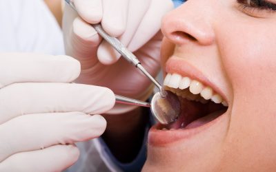 What You Need to Know About Dental Fixtures Buffalo NY Patients Trust for Restorations