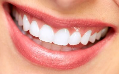 Families Trust Dentist Services Daytona Beach FL for Complete Oral Health Solutions