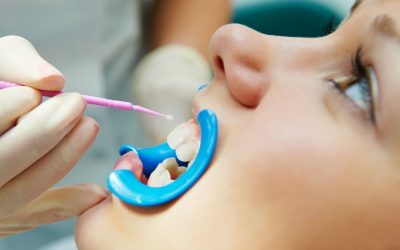 Personalized oral care solutions available from a dedicated local dentist in Parker CO